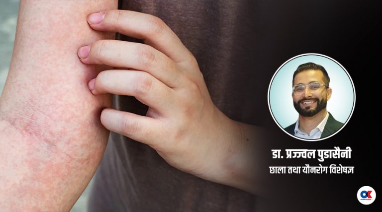 शरीर धेरै चिलाउनुको कारण र उपचार